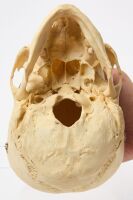 Clay Adams Human Skeleton with Case - 8