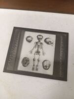 Collection of Medical and Oddity Photographs, Ephemera, Glass Slides - 3